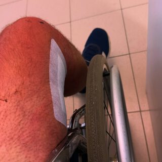 Nach meiner Operation geht’s bergauf. Leider sehr langsam. Aber das - so wurde mir mehrfach eingebläut - muss ich jetzt aushalten 🫣. Laufen an Gehhilfen ist momentan nur für sehr kleine Distanzen machbar, aber auch das wird sicher besser. Also passt immer auf euch auf bitte! Geht schneller mal schief, als wir es uns eingestehen wollen.