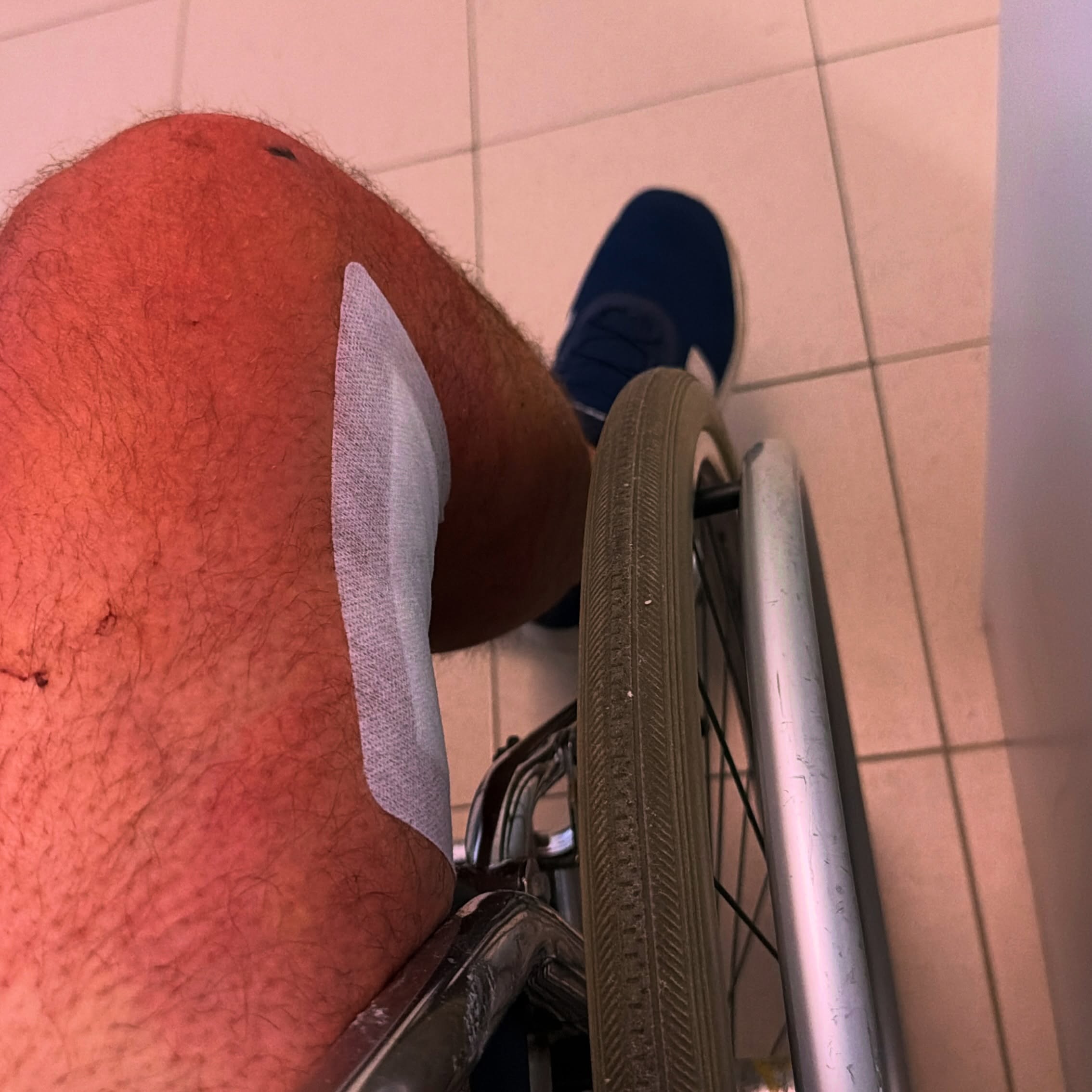 Nach meiner Operation geht’s bergauf. Leider sehr langsam. Aber das - so wurde mir mehrfach eingebläut - muss ich jetzt aushalten 🫣. Laufen an Gehhilfen ist momentan nur für sehr kleine Distanzen machbar, aber auch das wird sicher besser. Also passt immer auf euch auf bitte! Geht schneller mal schief, als wir es uns eingestehen wollen.